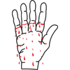 Bloody hand